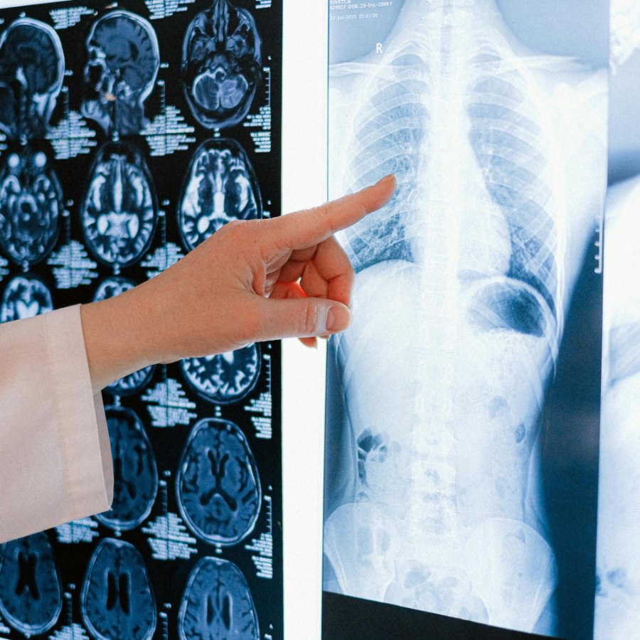 A clinician pointing to brain and chest images on an imaging lightbox